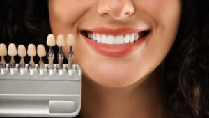 răng sứ cao cấp cercon
