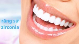 răng sứ zirconia