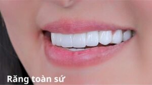 răng sứ toàn sứ